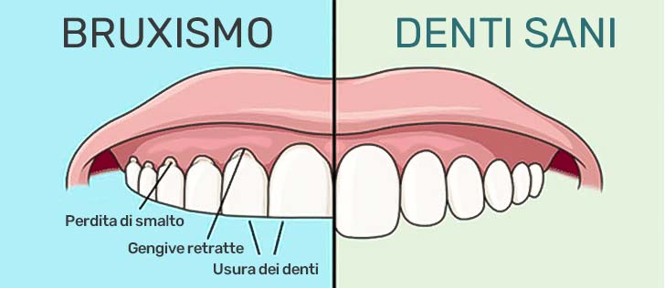 covid-e-denti-consumati