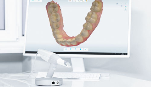 scanner-intraorale-Verona