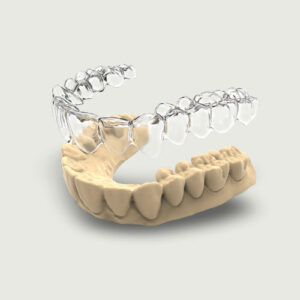 Ortodonzia invisibile