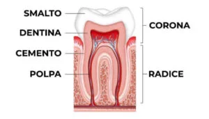 Endodonzia soluzioni dentali