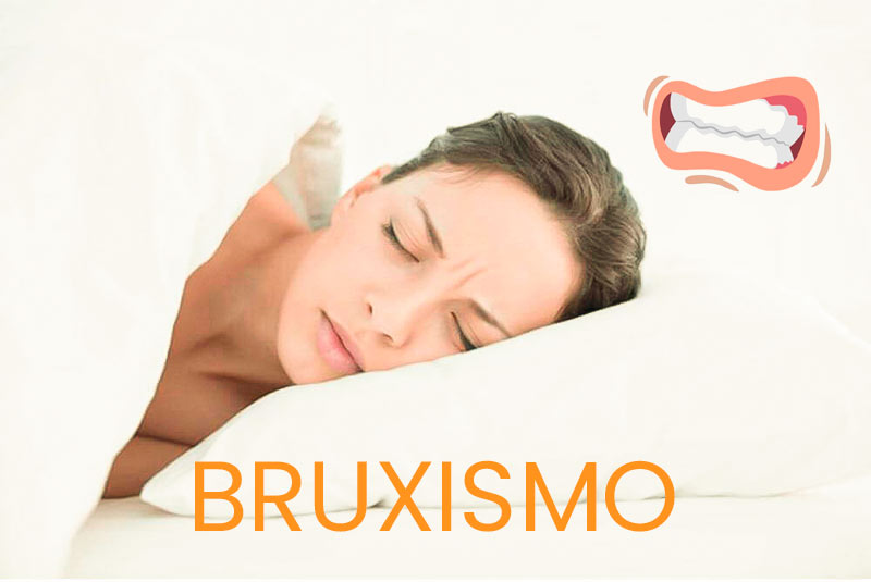 Bruxismo dentista verona