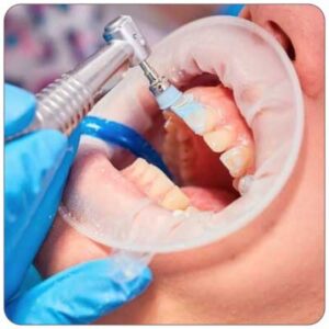 igiene-dentale-verona