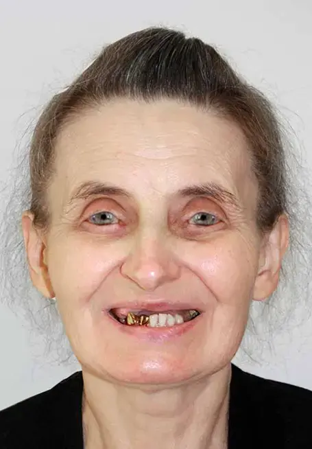 Prima